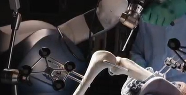 Tallahassee Orthopedic Clinic Introduces Advanced Robotic Arm-Assisted Knee Replacement